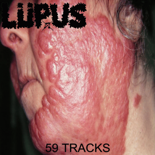 Lupus (BRA) : 59 Tracks